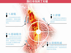 只需一分鐘，肩頸很輕松！——恒怡運(yùn)動(dòng)是有效的